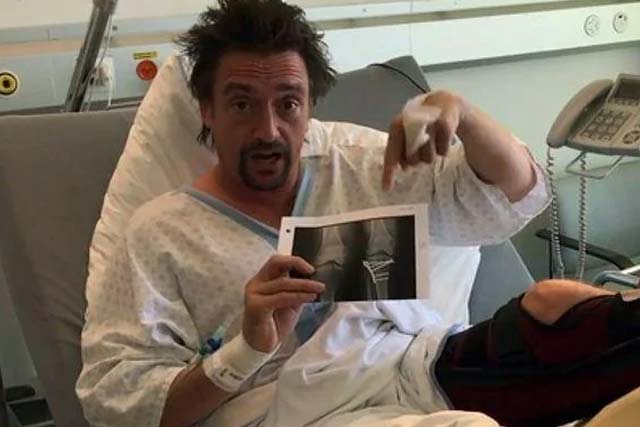 Richard Hammond reveals his injuries in hospital